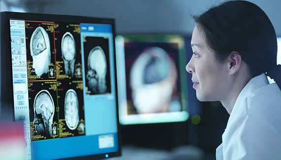 person in lab coat looks at MRI scans of skull