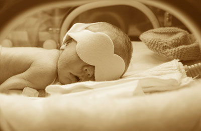 photo of premature infant