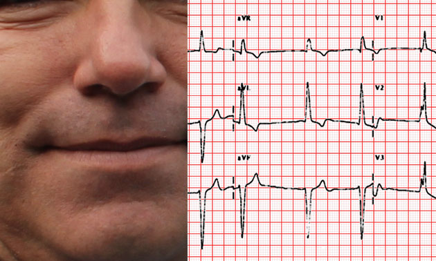 heart faces on ekg