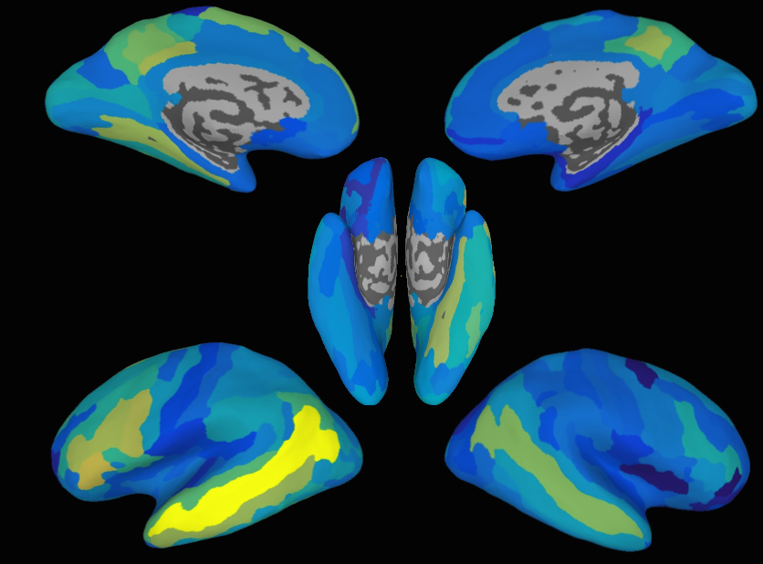 fMRI images of brain scan