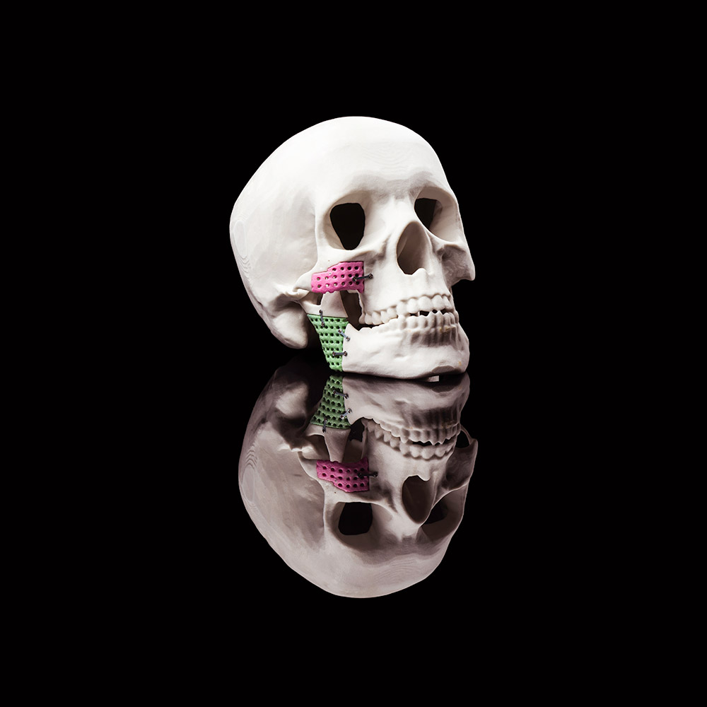 3-D model of a human skull