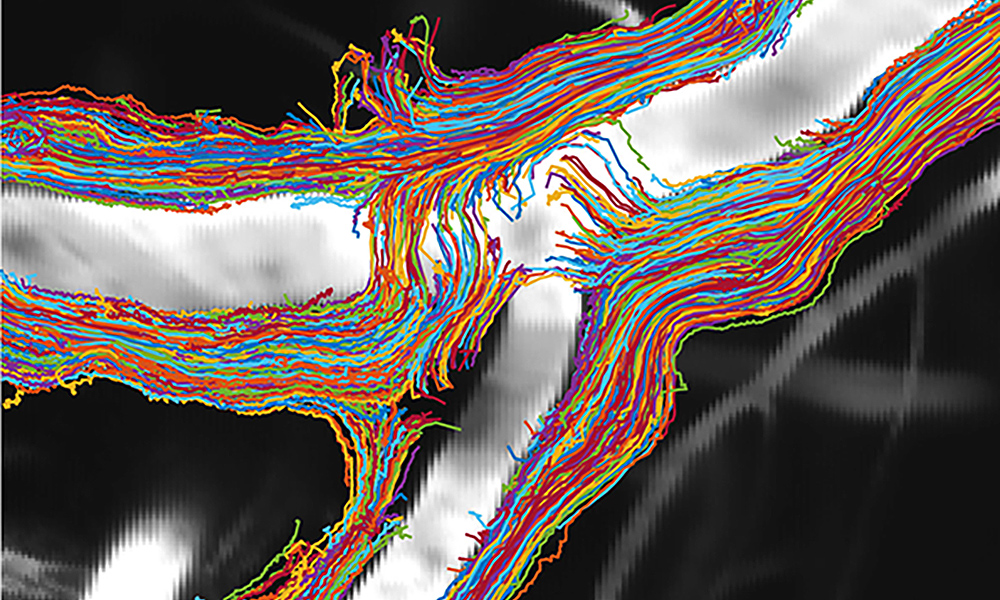 Illustration of fluid moving through an artery.