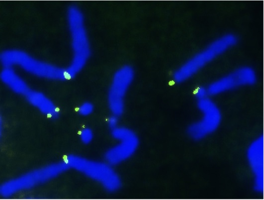 Chromosome strands appear in blue and centromeres appear in green. 
