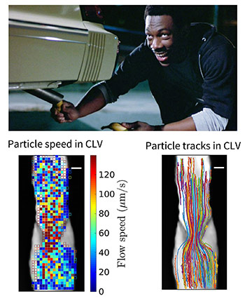 Two slides, one showing a still from the movie Beverley Hills Copy with Eddie Murphy, where he puts a banana in a tailpipe, and the other showing showing particle speeds and tracks in cervical lymph vessels.